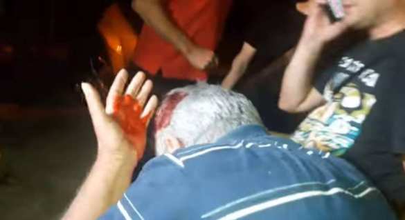 СРОЧНО: бойня в Киеве, прямая трансляция. Смотрите и комментируйте с «Русской Весной» (ФОТО, ВИДЕО 18+) | Русская весна