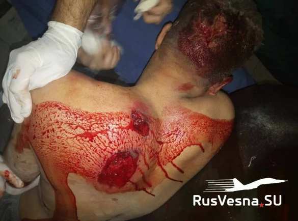 Кровавая бойня в Сирии: план врага по захвату части страны (ФОТО 18+) | Русская весна