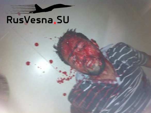 Сирия: обстановка напряжённая, враг нанёс смертоносный удар (ФОТО 18+) | Русская весна