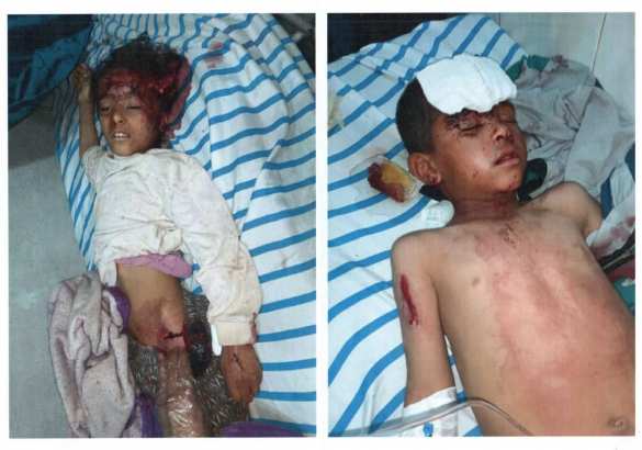 Чудовищные зверства турок в Сирии: кровь детей льётся рекой (ФОТО 18+) | Русская весна