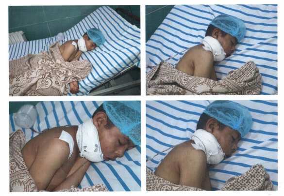 Чудовищные зверства турок в Сирии: кровь детей льётся рекой (ФОТО 18+) | Русская весна