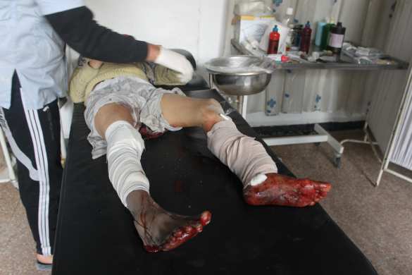 Кровавый террор жилых кварталов в Алеппо, Дамаске, Идлибе и Латакии (ВИДЕО, ФОТО 18+) | Русская весна