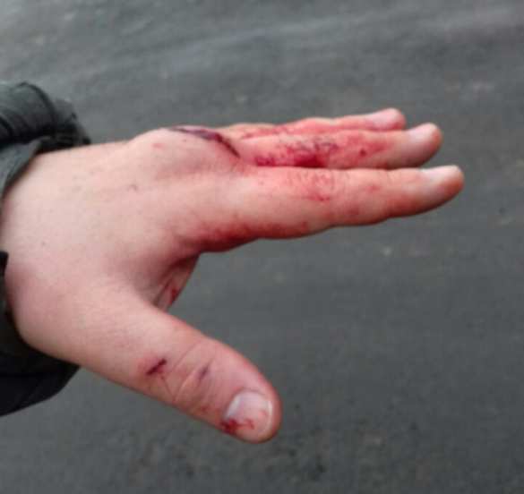 В Харькове избили «активиста» местного Евромайдана (ФОТО) | Русская весна