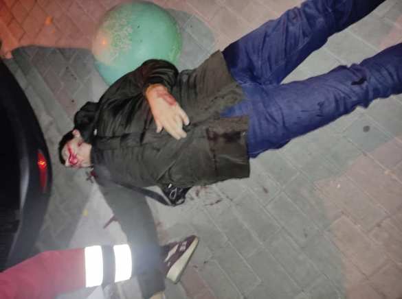 Боевика «Правого сектора» застрелили в Сумах (ФОТО, ВИДЕО 18+) | Русская весна