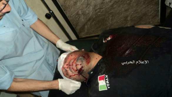 Алеппо в огне: террористы при поддержке Турции продолжают атаки на города (ФОТО) | Русская весна