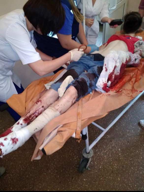 Под Горловкой тяжело ранен подросток (ФОТО 18+) | Русская весна