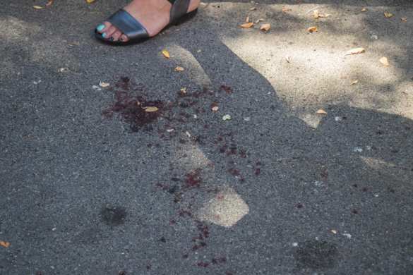 В Киеве «атошнику» оторвало руку мусоровозом (ФОТО) | Русская весна