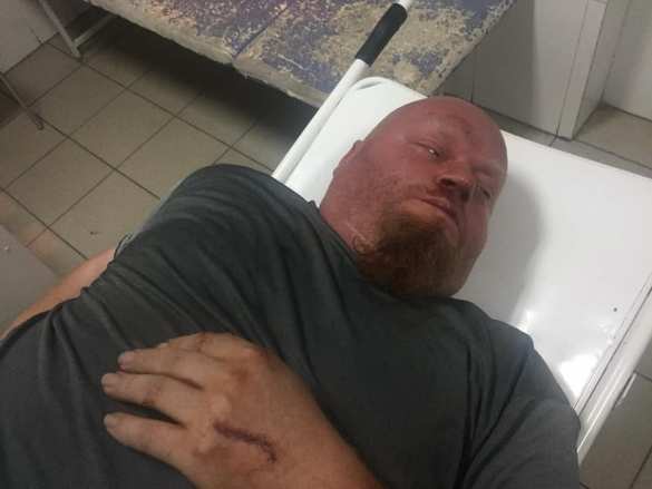 Массовое побоище в Харькове: нацисты напали на «атошников» (ФОТО 18+) | Русская весна