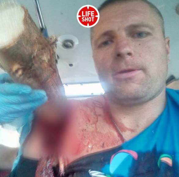 «Белорусский Халк»: экстремала насквозь пробило сосной (ФОТО, ВИДЕО 18+) | Русская весна