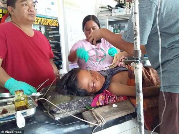 Отец покусал крокодила, чтобы спасти из его пасти сына (ФОТО) | Русская весна