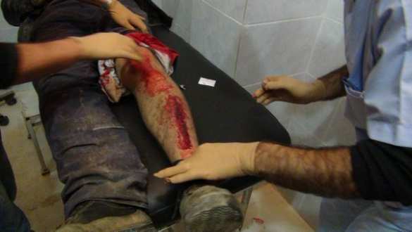 Кровавая ночь в Африне: после турецкого обстрела убиты и ранены дети, в больнице идут операции (ФОТО, ВИДЕО 18+) | Русская весна