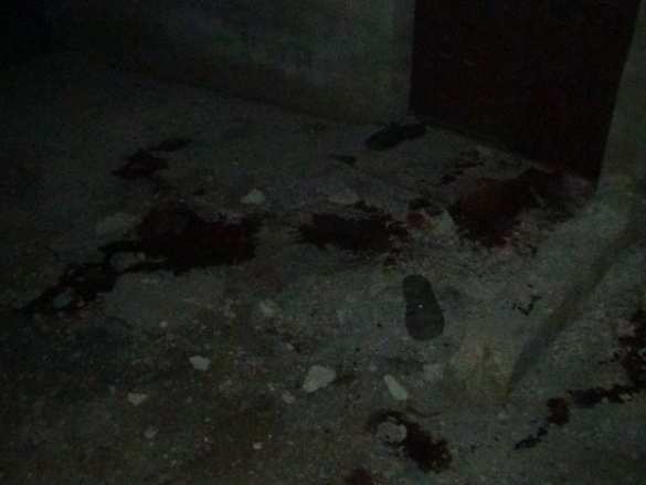 Кровавая ночь в Африне: после турецкого обстрела убиты и ранены дети, в больнице идут операции (ФОТО, ВИДЕО 18+) | Русская весна