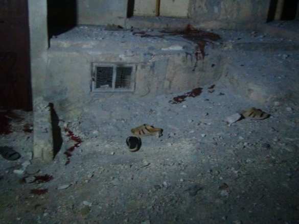 Кровавая ночь в Африне: после турецкого обстрела убиты и ранены дети, в больнице идут операции (ФОТО, ВИДЕО 18+) | Русская весна