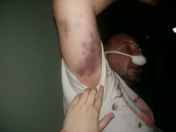 Шок для «патриотов»: в Киеве полиция избила «атошников», устроивших потасовку в кафе (ФОТО, ВИДЕО 18+) | Русская весна