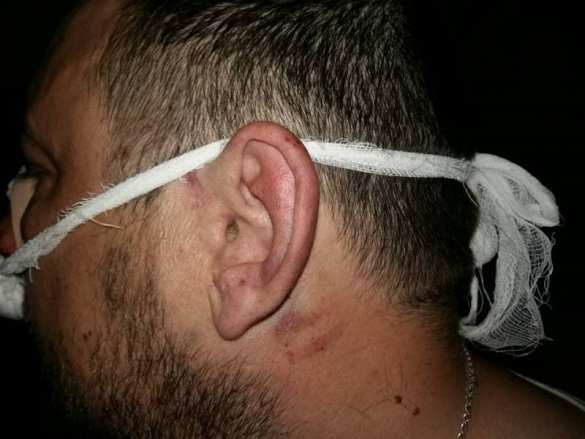 Шок для «патриотов»: в Киеве полиция избила «атошников», устроивших потасовку в кафе (ФОТО, ВИДЕО 18+) | Русская весна