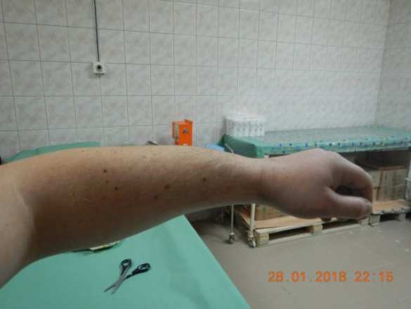 Избит сторонник Навального, обвинённый в мошенничестве людьми Ходорковского (ФОТО) | Русская весна