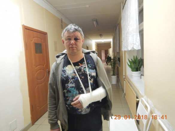 Избит сторонник Навального, обвинённый в мошенничестве людьми Ходорковского (ФОТО) | Русская весна