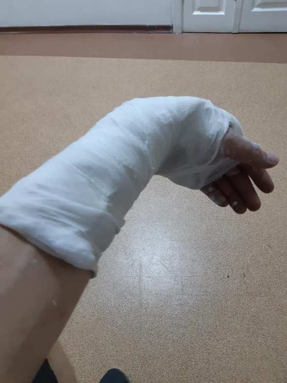 В Днепропетровске жестоко избили карателя (ФОТО) | Русская весна