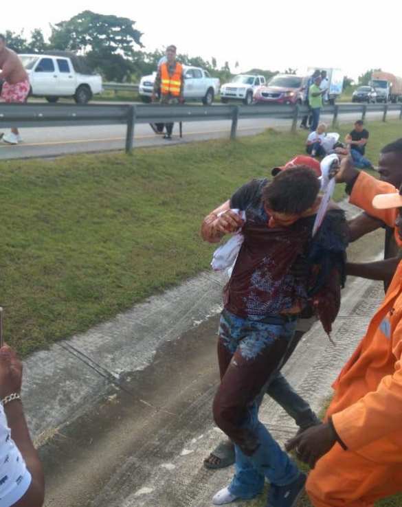 Страшные кадры: Автобус с российскими туристами столкнулся с грузовиком в Доминикане (ВИДЕО, ФОТО 18+) | Русская весна