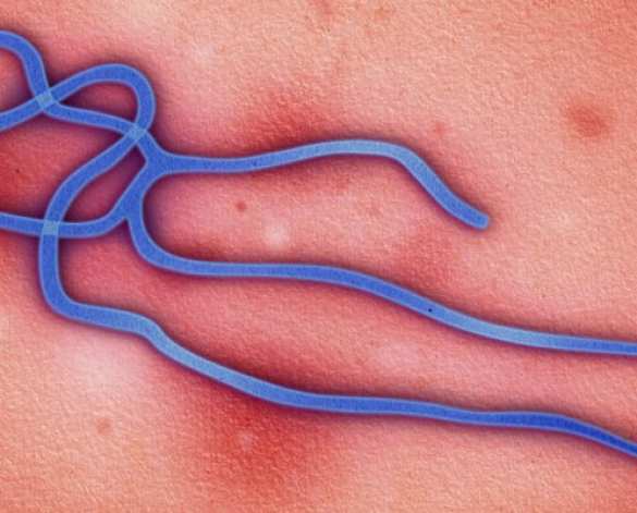 Компьютерная игра «Уничтожь Эболу»: Ради победы придется цинично переступать через страдания детей | Русская весна