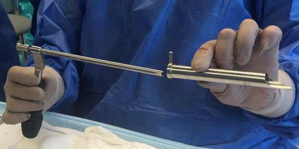 Российские военные врачи впервые выполнили уникальную операцию на позвоночнике (+ФОТО) | Русская весна