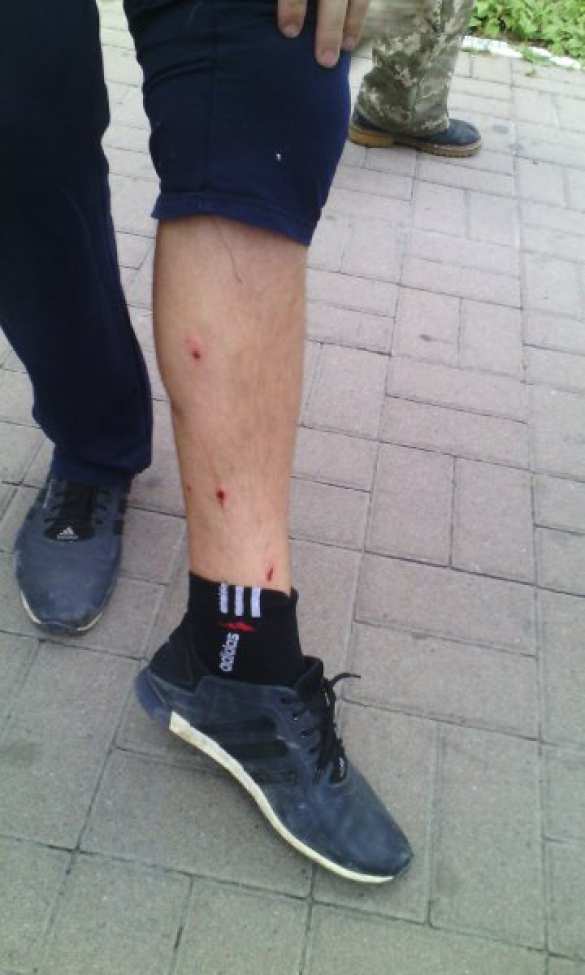 В Ровенщине столкновения с нацгвардией, звучит стрельба, есть раненые — ситуация вышла из под контроля (ВИДЕО+ФОТО) | Русская весна