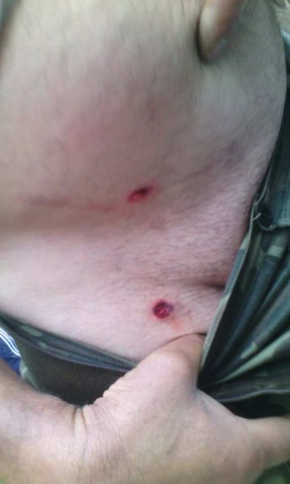 В Ровенщине столкновения с нацгвардией, звучит стрельба, есть раненые — ситуация вышла из под контроля (ВИДЕО+ФОТО) | Русская весна