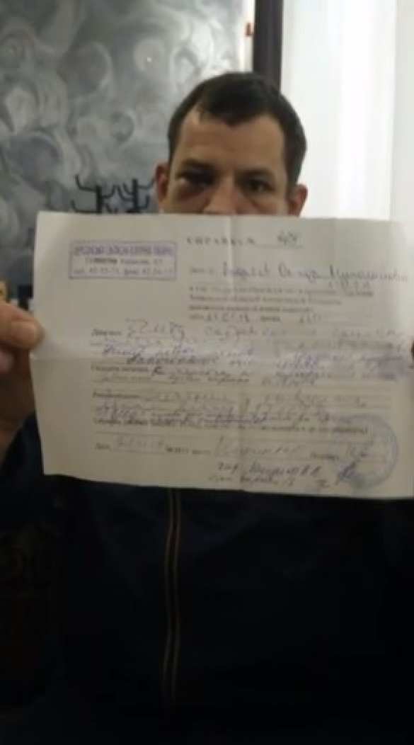 Хорошо погуляли: На вечеринке в Херсоне одному полицейскому разбили голову, а другого выбросили с пятого этажа (+ФОТО, ВИДЕО) | Русская весна