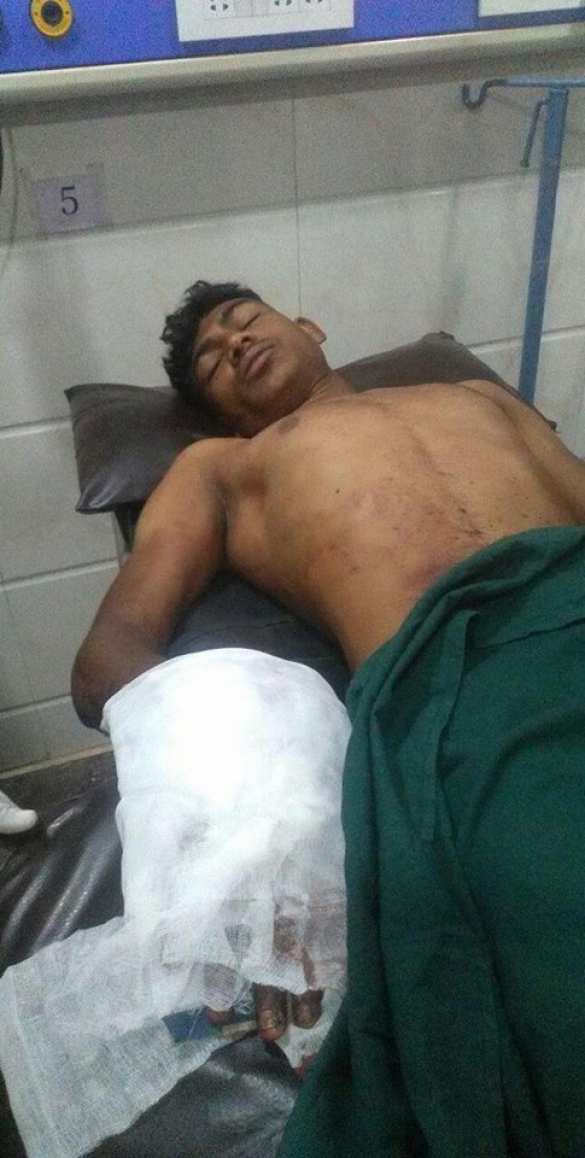 В Индии отец отрубил сыну руку, пытаясь «излечить» его от порнозависимости (+ФОТО) | Русская весна