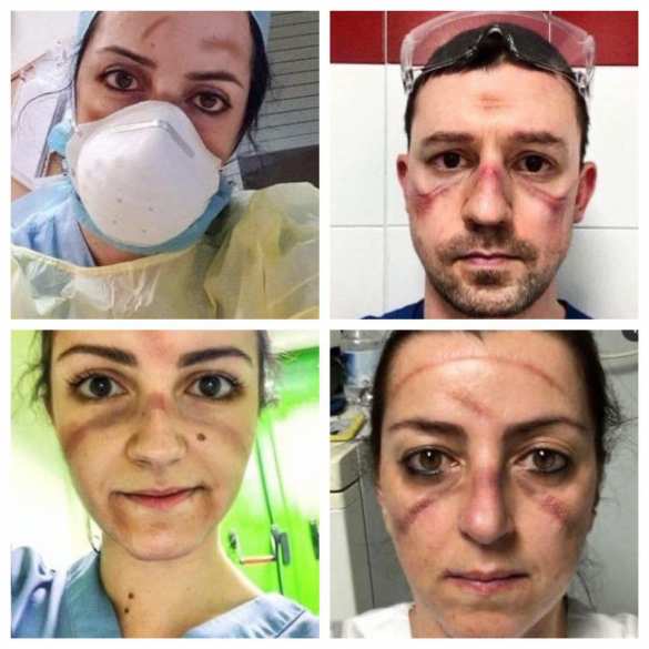 Ад в Италии: Почему столько жертв коронавируса и отчего в России всё не так? (ФОТО) | Русская весна