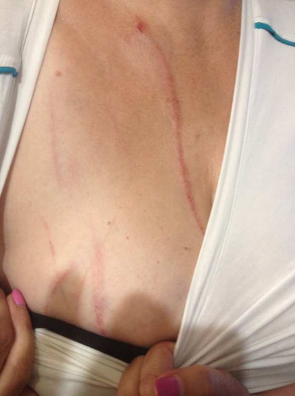 «Сепаратизм поднимает голову»: в Днепропетровске избили «АТОшника» с женой (ФОТО) | Русская весна