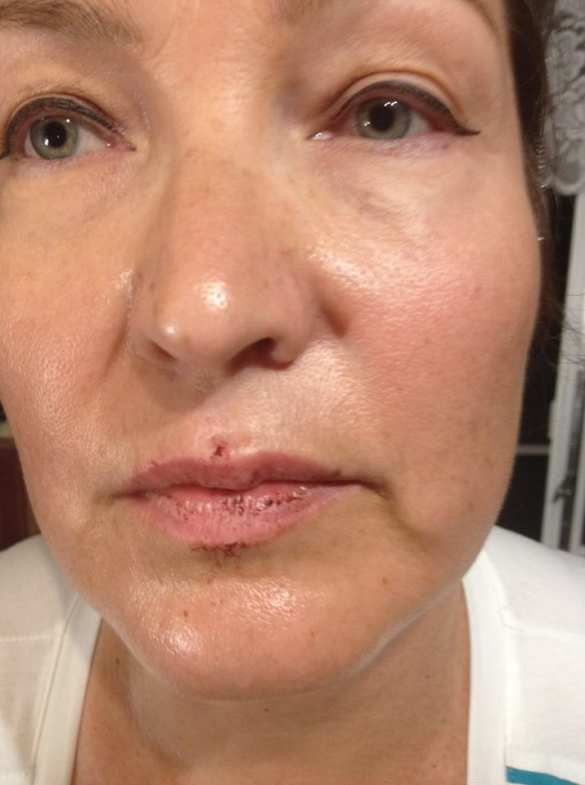 «Сепаратизм поднимает голову»: в Днепропетровске избили «АТОшника» с женой (ФОТО) | Русская весна