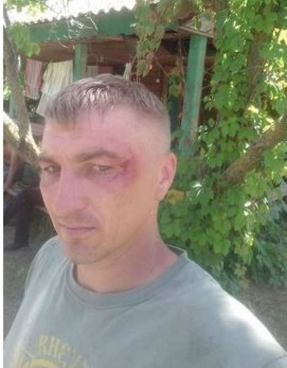 Вот вам и «новая полиция»! Животные! — «атошников» избили в детском лагере (+ФОТО) | Русская весна