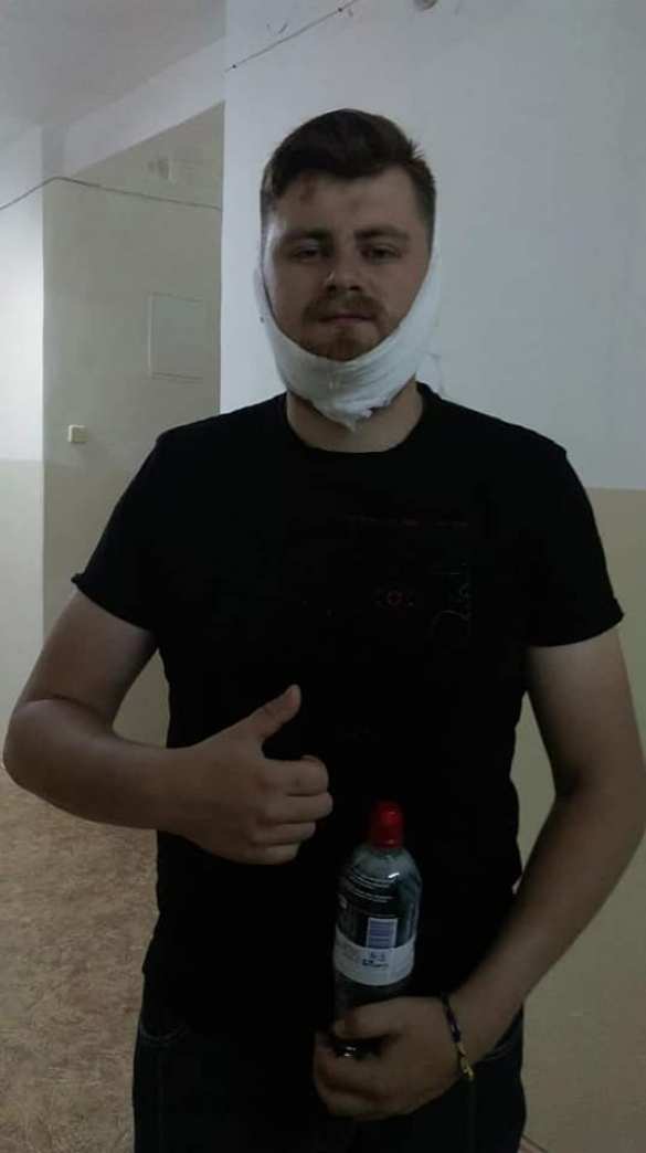 Карателю-«АТОшнику» сломали челюсть за выкрик «Слава Украине» (ФОТО) | Русская весна