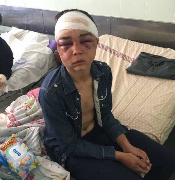Дикая Украина: Мужчины зверски пытали и насиловали подростка из-за девушки (ФОТО, ВИДЕО) | Русская весна