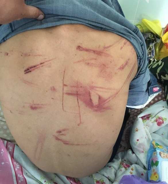 Дикая Украина: Мужчины зверски пытали и насиловали подростка из-за девушки (ФОТО, ВИДЕО) | Русская весна