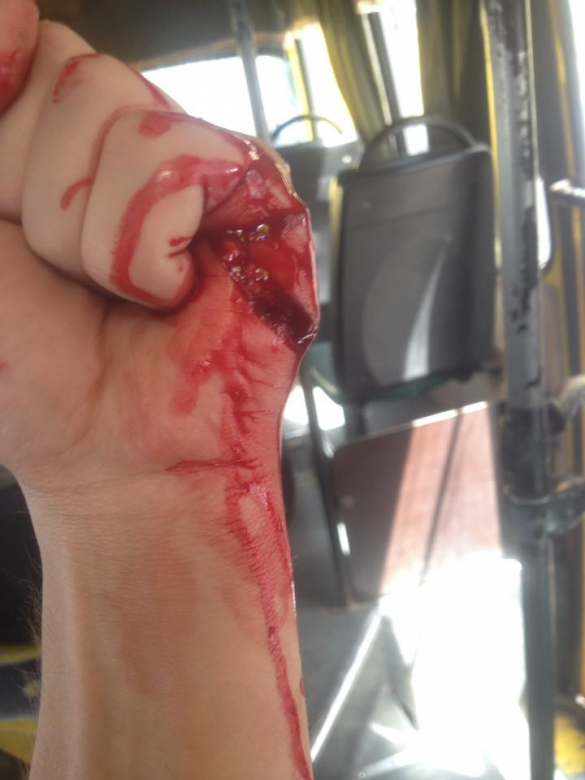 В Киеве водитель маршрутки порезал «АТОшника» (ФОТО 18+) | Русская весна