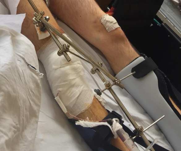 В Киев прибыл борт с ранеными карателями (ФОТО) | Русская весна