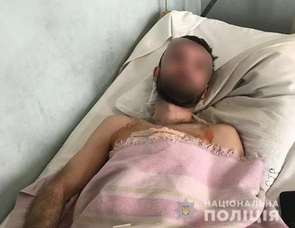 В Киеве экс-командир разведки ДНР открыл огонь по двум полицейским (ФОТО, ВИДЕО) | Русская весна