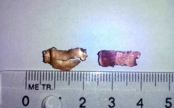 Трое детей ранены на Донбассе взрывом боеприпаса (+ФОТО) | Русская весна