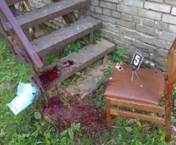 Кровавая драма в сельском кабинете стоматолога на Львовщине: врачу перерезали вены (ФОТО 18+) | Русская весна