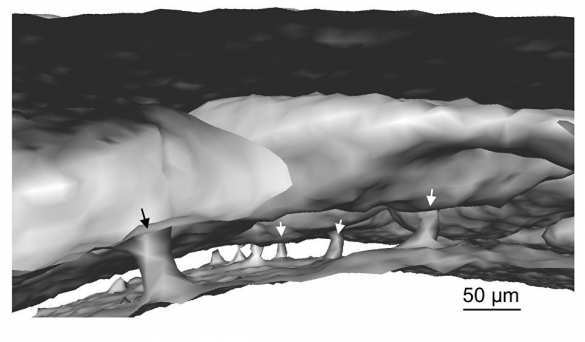 Учёные открыли загадочные каналы, соединяющие мозг и кости черепа (ФОТО) | Русская весна