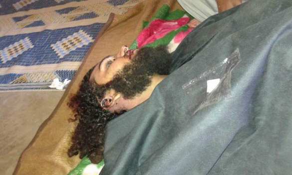 12 Ад в Алеппо: наступление банд обернулось кровавым провалом — убиты сотни боевиков (КАРТА, ВИДЕО, ФОТО 18+) | Русская весна