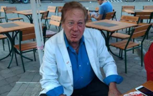 Стало известно, кто избил американского певца в Одессе (ФОТО) | Русская весна