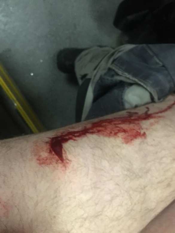 В Одессе напали на известного неонациста (ФОТО) | Русская весна