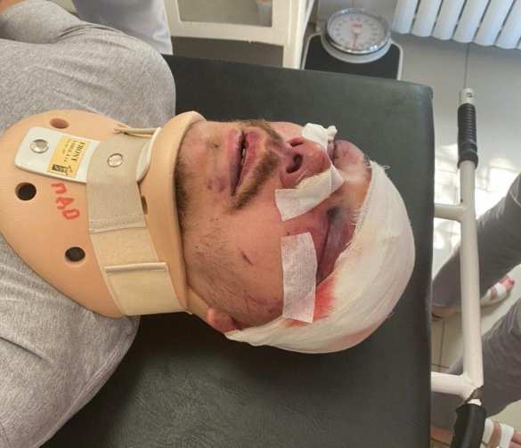 Жестокое избиение активиста «Партии Шария» — ход следствия изменился | Русская весна