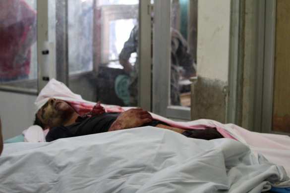 Террористы подвергли Алеппо самому страшному обстрелу, убиты и ранены более 20 человек (ФОТО 18+) | Русская весна