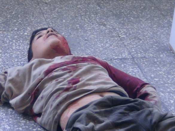 «Спасите, нас уничтожают!» — за жителями Алеппо охотятся снайпера, боевики убивают сирийцев с помощью «Адского огня» — репортаж (ВИДЕО, ФОТО 18+) | Русская весна