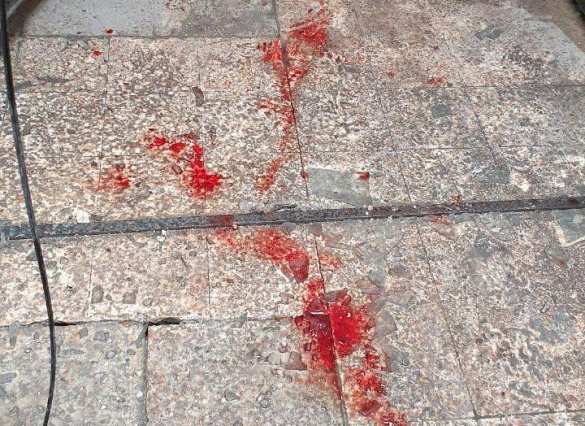 Жуткие кадры: Враг нанёс удар по самому крупному городу Сирии (ФОТО 18+) | Русская весна