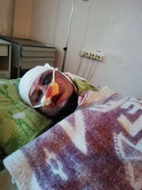 Под Днепропетровском проломили голову и сломали челюсть боевику «Нацдружин» (+ФОТО) | Русская весна